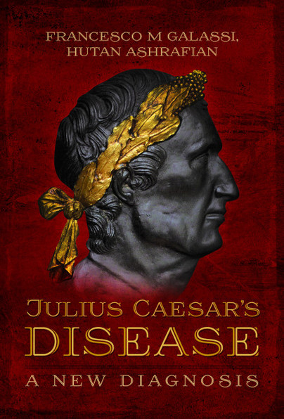 Julius Caesar’s Disease