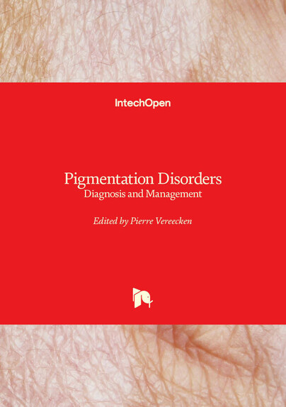 Pigmentation Disorders
